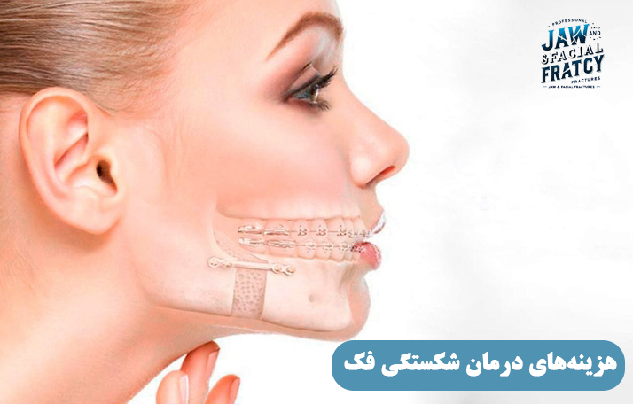 هزینه‌های درمان شکستگی فک