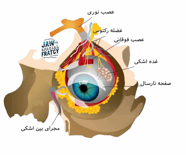 شکستگی کاسه چشم