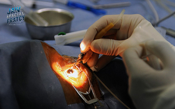 بهترین دکتر شکستگی کاسه چشم تهران