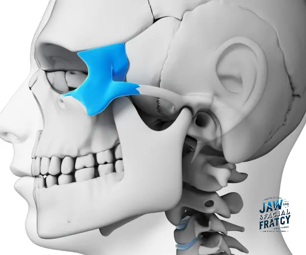 تفاوت شکستگی گونه با شکستگی فک و بینی