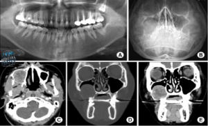 رادیولوژی جراحی فک
