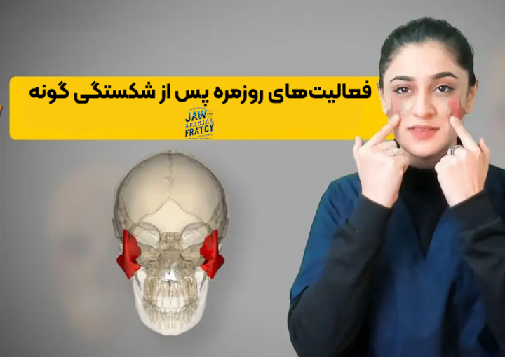 فعالیت‌های روزمره پس از شکستگی گونه