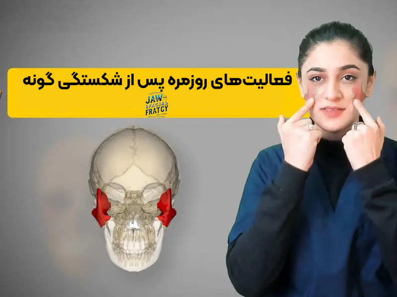 فعالیت‌های روزمره پس از شکستگی گونه