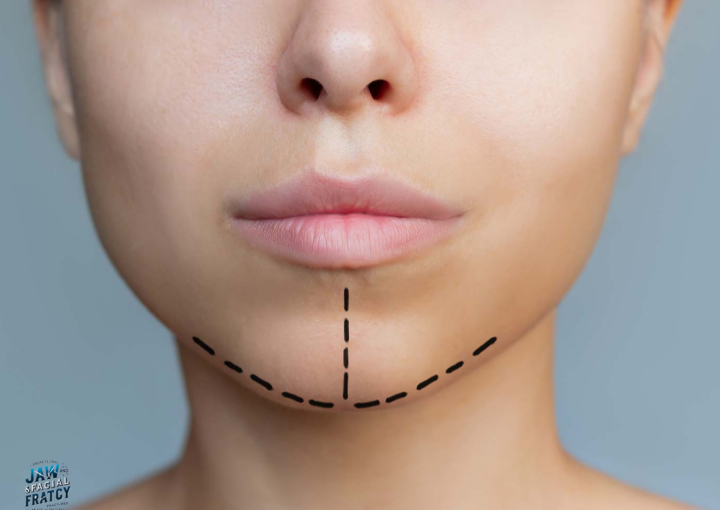 آیا شکستگی فک باعث کج شدن صورت می‌شود؟