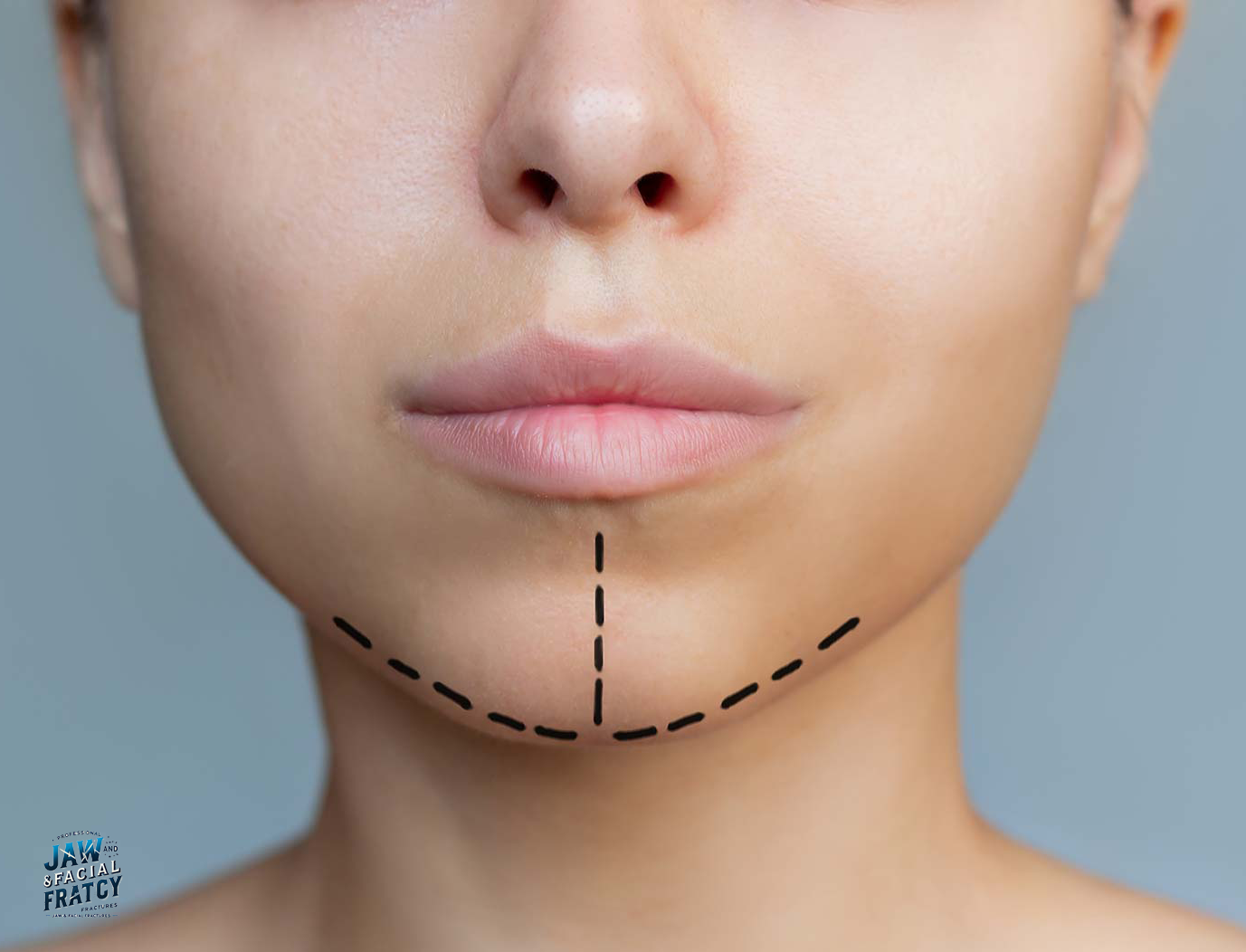 آیا شکستگی فک باعث کج شدن صورت می‌شود؟