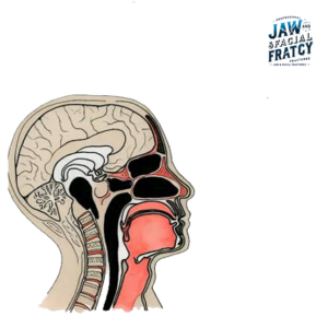 خرخر بعد از شکستگی بینی