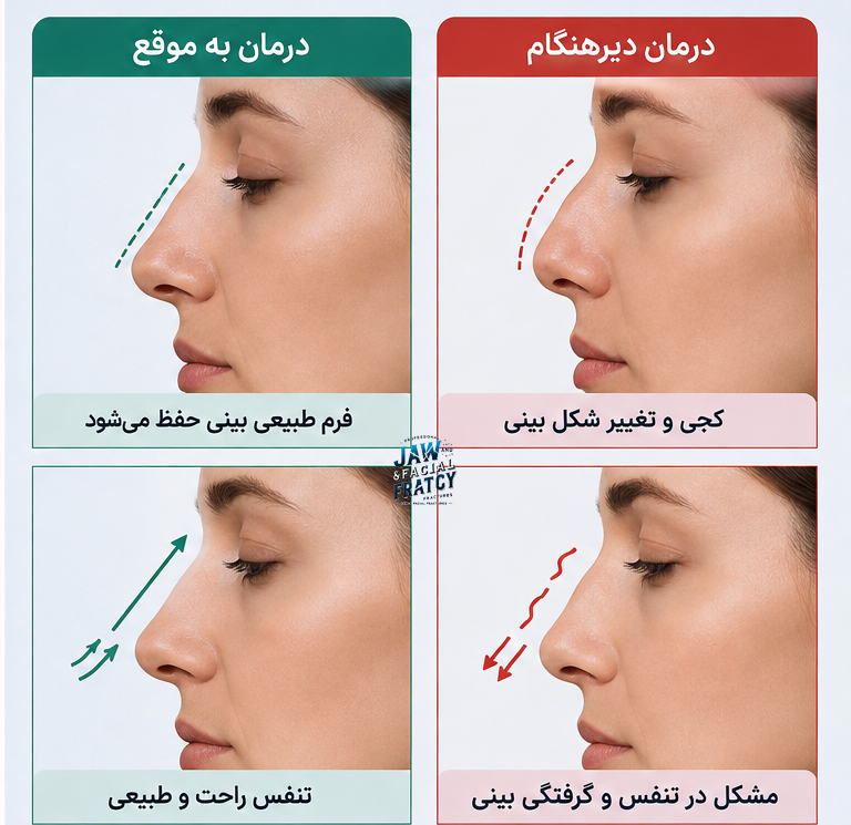 وارض دیر درمان کردن بینی شکسته