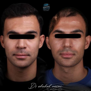 بهترین جراح درمان تروماهای صورت